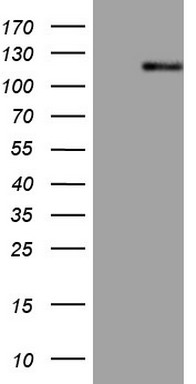 PRKAB2 Antibody