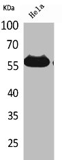 AMY1A Antibody