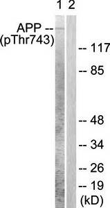 Amyloid β A4 (Phospho-Thr743/668) Antibody