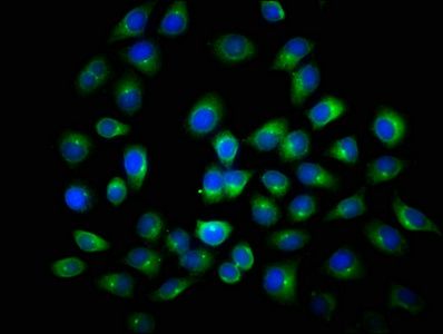 ANAPC2 Antibody