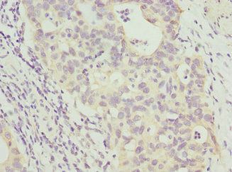 ANAPC2 Antibody