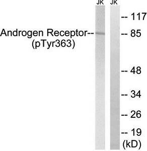 Androgen Receptor (Phospho-Tyr363) Antibody