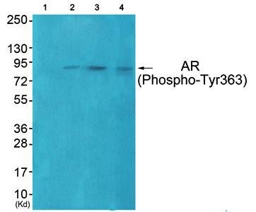 Androgen Receptor (Phospho-Tyr363) Antibody
