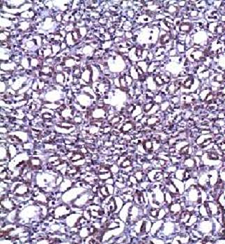 ANG2 Rabbit Polyclonal Antibody