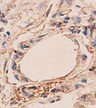 ANG4 Rabbit Polyclonal Antibody
