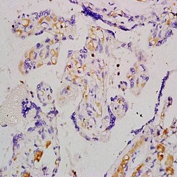 Angiomotin Rabbit Polyclonal Antibody