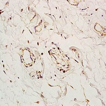 Angiomotin Rabbit Polyclonal Antibody
