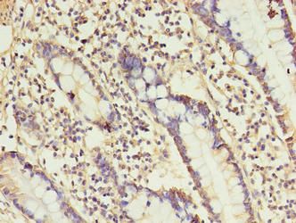 ANGPTL2 Antibody