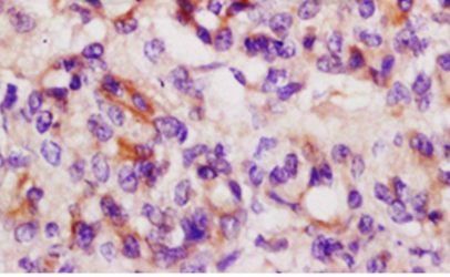 Angiopoietin 4 Rabbit Polyclonal Antibody
