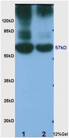 Angiopoietin 4 Rabbit Polyclonal Antibody
