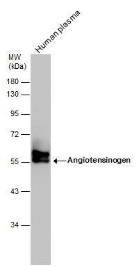 Angiotensinogen antibody [N1C3]