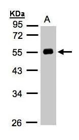 Angiotensinogen antibody [N1C3]