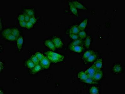 AGT Antibody