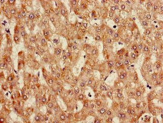 ANGPTL3 Antibody