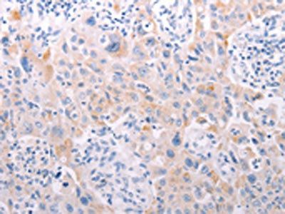 ANKRA2 Antibody