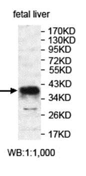 ANKRA2 Rabbit Polyclonal Antibody
