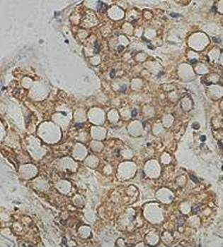 ANKRA2 Rabbit Polyclonal Antibody