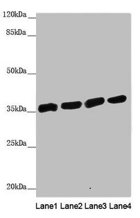 ANKRD1 Antibody