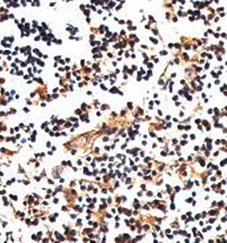 Cannabinoid receptor 2 Rabbit Polyclonal Antibody