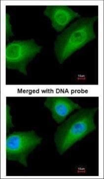 Annexin A1 antibody
