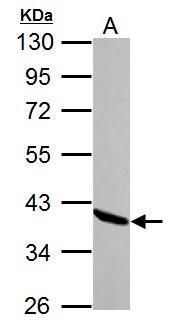 Annexin A1 antibody