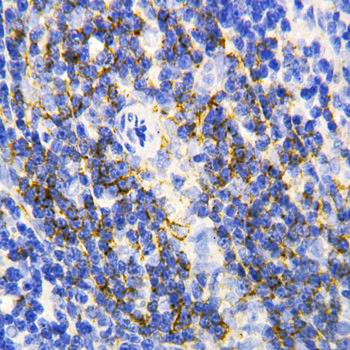 Annexin VI/ANXA6 Antibody