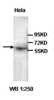 Annexin A11 Rabbit Polyclonal Antibody
