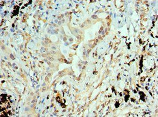 ANTXR1 Antibody