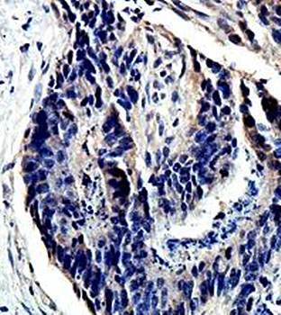 ANTXR1 Rabbit Polyclonal Antibody