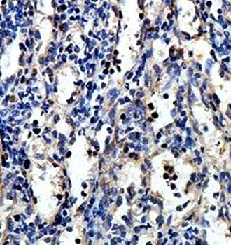 ANXA3 Rabbit Polyclonal Antibody