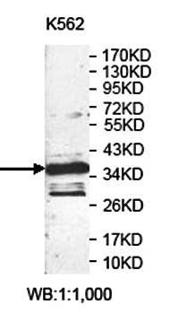 ANXA3 Rabbit Polyclonal Antibody