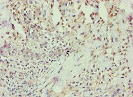 ANXA7 Antibody