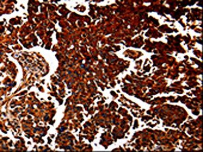 ANXA7 Antibody