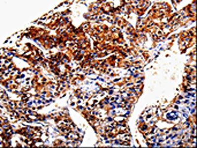 ANXA7 Antibody