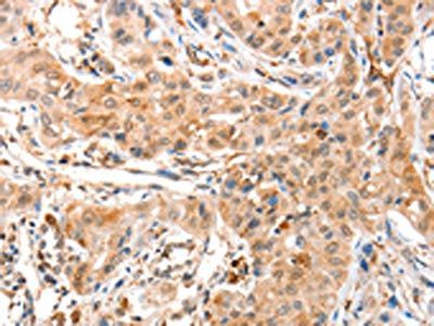 ANXA8 Antibody