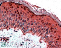 AP-2 gamma Antibody