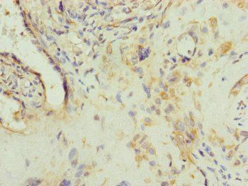 AP1M1 Antibody