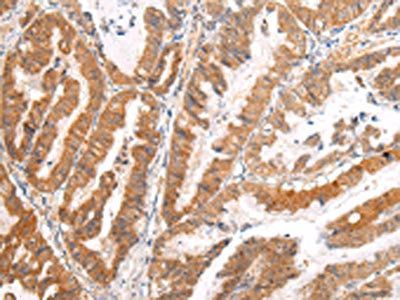 AP2A1 Antibody