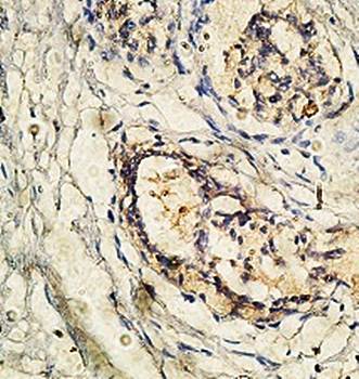 AP2A1 Rabbit Polyclonal Antibody