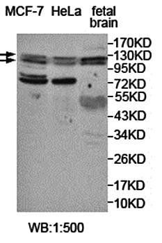AP2A1 Rabbit Polyclonal Antibody