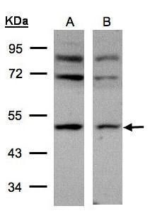 AP2M1 antibody