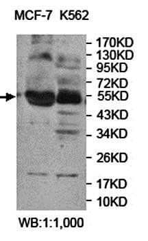 AP2M1 Rabbit Polyclonal Antibody