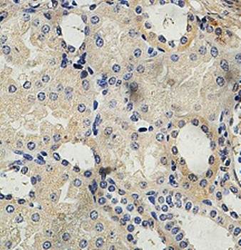 AP2M1 Rabbit Polyclonal Antibody