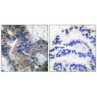 APAF1 Antibody