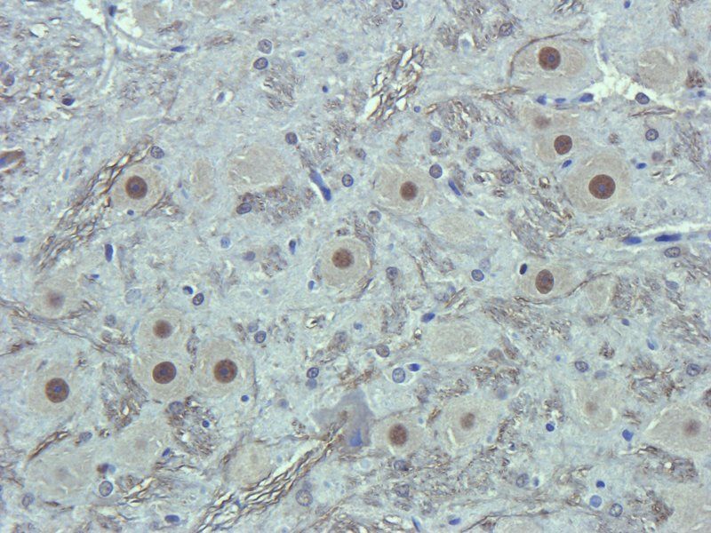 Apelin Rabbit Polyclonal Antibody