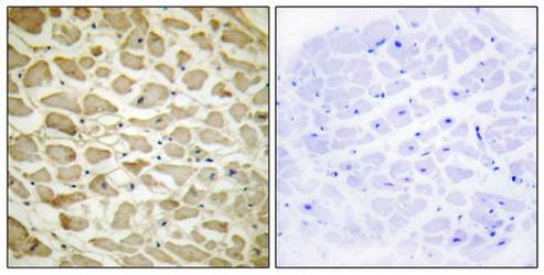 Collagen XIV α1 Antibody