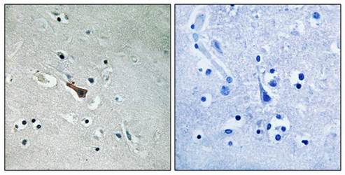 APLP2 (Phospho-Tyr755) Antibody