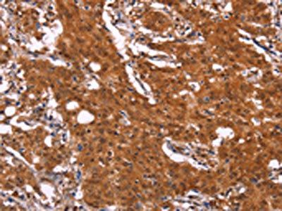 APMAP Antibody