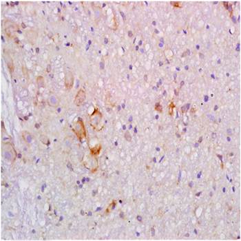 ApoB Rabbit Polyclonal Antibody