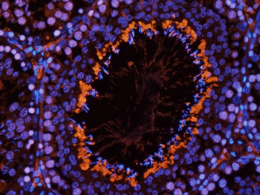 APOBEC3B Rabbit Polyclonal Antibody